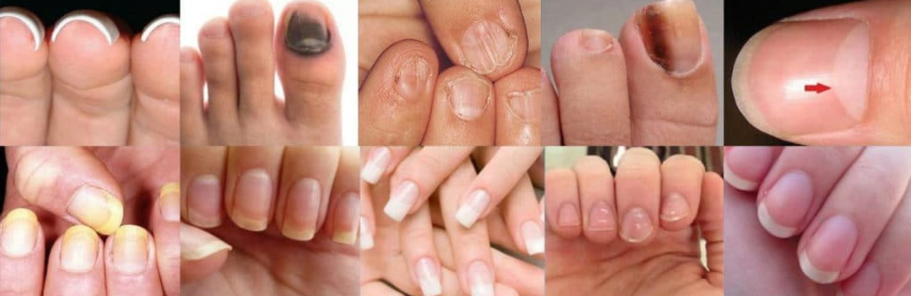 Facts About Nails